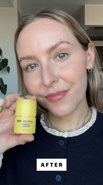 Kinonen after applying the CNP Propolis Lipcerin Lip Balm