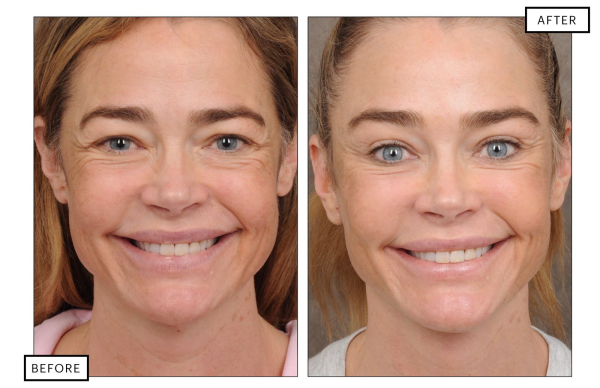 Image may contain Head Person Face Photography Portrait Adult Happy Smile Body Part Mouth Teeth Art and Collage